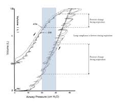 Dynamic lung compliance refers to the ratio of the change in volume to the change in pressure over a tidal breath, with the pressure measured at moments of zero flow during breathing. Static Dynamic And Specific Compliance Deranged Physiology