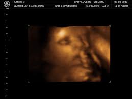 Cris Fountain Obituary (2008)