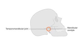 Image result for Jaw Dislocation