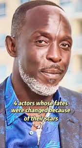 Michael Hollick Scar