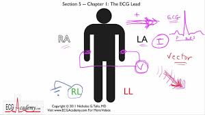 Ecg Lead Positioning Litfl Medical Blog Ecg Library Basics