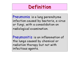The other main type of. Pneumonia Prof Dr Bilun Gemiciolu Definition Pneumonia Is