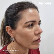 Dr. Carlos Roblero...