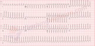 ────────── all medical (2) electronics (3) physics (1) universities (1) amex symbols (1) companies & firms (1). Teaching Medicine Tutorial Rhythm Diagnostic Criteria