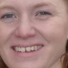 Lymphoedema healer's group talk