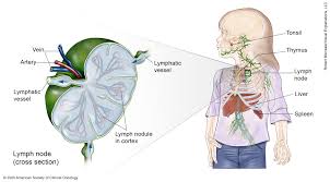 Human body is a complex combination of many body parts. Lymphoma Hodgkin Childhood Medical Illustrations Cancer Net