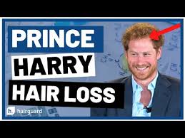 Prince Harry's Hair Loss: What Is Going ...