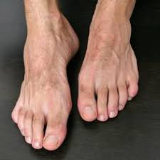The slender man (also spelled slenderman) is a fictional supernatural character that originated as a creepypasta internet meme created by something awful forum user eric knudsen (also known as victor surge) in 2009. 18 Most Special Ideas Male Feet Barefoot Men Bare Men