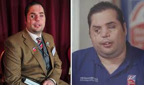 Blind veteran Simon Brown talks about struggle