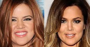 Jobs apply to jobs posted by clients. Khloe Kardashian Plastic Surgery Before And After Nose Job Kardashian Plastic Surgery Khloe Kardashian Plastic Surgery Plastic Surgery