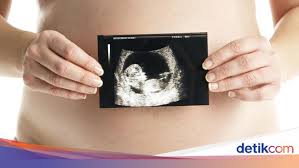 Bahkan pada janin yang lebih besar bisa tampak buah zakar yang berada dalam kantung zakar. Canggihnya Usg 4d Bisa Lihat Kondisi Janin Dalam Kondisi Real Time