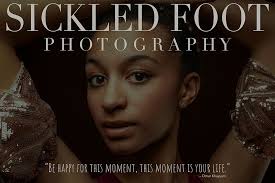 Sickled Foot Photography
