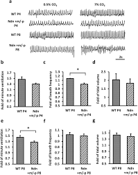Taman molek johor bahru, johor malezya. Firing Activity Of Locus Coeruleus Noradrenergic Neurons Decreases In Necdin Deficient Mice An Animal Model Of Prader Willi Syndrome Journal Of Neurodevelopmental Disorders Full Text