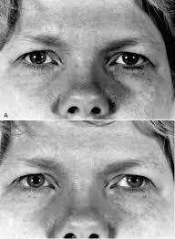 Foundation Volume 2, Chapter 9. The Iris and the Pupil