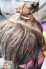 Biovea.net has been visited by 10k+ users in the past month How To Get Rid Of Lice Nits Without Chemicals Living Well Mom