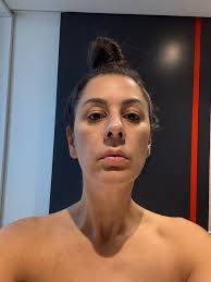 Turkey is the place for great plastic surgery. My next one is a face lift.  I got dental done in Istanbul.