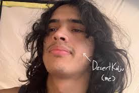 Fundraiser by DESERT KAIJU : Help me get surgery!