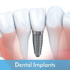 Check spelling or type a new query. Bayside Oral Surgery Valerie Byrnside Dds