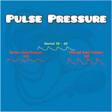 Image result for Pulse Pressure