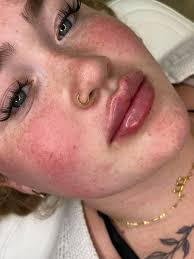 If anyone was at Tesco before 8am this morning and are missing their photos  I have given them into the security guard