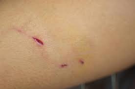 Once the fleas bite on your pet, they become itchy and have visible bumps on their skin. 162 Dog Bite Wound Photos Free Royalty Free Stock Photos From Dreamstime