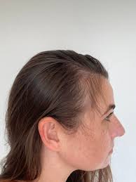Regrowing hair with clean ingredients