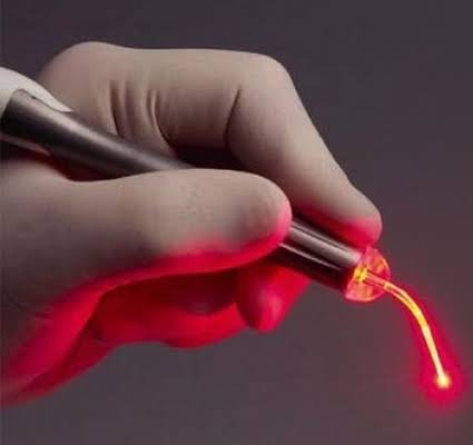 Laser surgery for Piles, Fissure and fistula product image