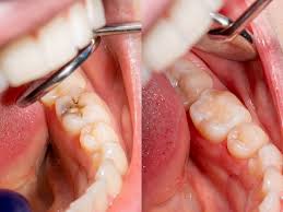 They also appear in other related business categories including health insurance, insurance, and life insurance. Dental Fillings In Modesto Ca Dentist Modesto Ca