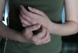 Scabies During Pregnancy Reasons Signs Diagnosis Treatment