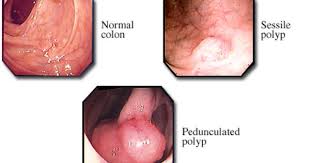 Pin On Health