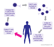 Image result for who should get car t treatment age