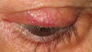 Image result for Blepharis sol