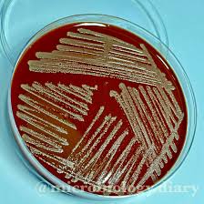 Image result for Neisseriaceae