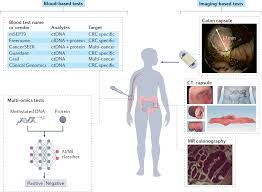 Image result for Colon Cancer Screening with Colonoscopy