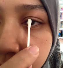 822 likes · 1 talking about this. Langkah Rawat Masalah Ketumbit Supaya Cepat Sembuh Vanilla Kismis