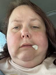 Please help!!! I had a tooth extracted two days ago and a abscess drained.  Today I'm in the worst pain ever goes this look like normal healing???