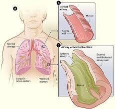 Pin On Pathophysiology