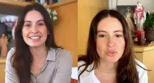 Qué es el vitiligio y por qué se da? Enfermedad rara que tiene Taliana  Vargas