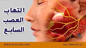 التهاب العصب السابع أخطر أمراض الشتاء الأعراض وطرق العلاج Egylasik Lasik Movie Posters Seventh