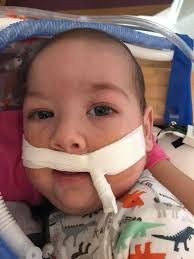 Lennix's Progress with Hypoplastic Left Heart Syndrome