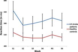 There are two main types of stroke: Forschungszentrum Julich Announcements Timing Independent Spatial Motor Sequence Learning Is Preserved In Left Hemisphere Stroke