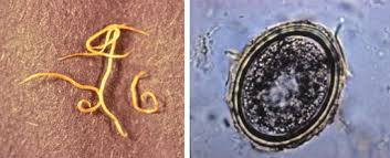 Image result for Helminth