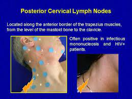 Maybe you would like to learn more about one of these? Lymph Nodes Examination Examination Of The Lymphatic System