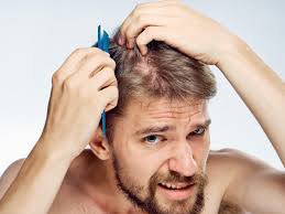 MẸO PHỤC HỒI TÓC KHÔ XƠ ĐƠN GIẢN CHO NAM GIỚI - LuxuryMan