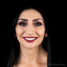 You are not stuck with the teeth you have 🙌 She thought she needed braces  and bleaching for white, straight teeth. She thought veneers could look  fake and be too expensive. [Sign