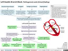 Left Bundle Branch Block Pathogenesis And Clinical Findings Calgary Guide Bundle Branch Block Medical Facts Emergency Nursing