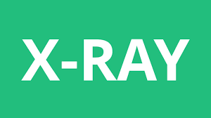 How To Pronounce X Ray Pronunciation Academy Youtube