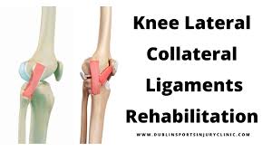 Diagnosing an injury to this ligament can be challenging in the setting of multiligamentous trauma; Knee Lateral Collateral Ligament Rehabilitation Dublin Sports Injury Clinic
