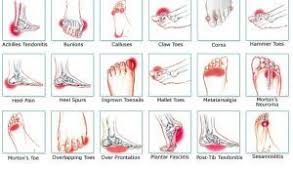 Pin On Fitness