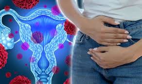 When this process begins, there may be no or only vague symptoms. Ovarian Cancer A Constant Feeling Of Being Bloated Could Indicate The Disease Express Co Uk